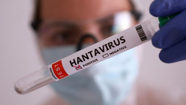 Kasus Hantavirus Sudah Masuk di Indonesia, Kemenkes: Saat ini Ada 2 Kasus Suspek di Jakarta dan Yogyakarta Kasus Hantavirus Sudah Masuk di Indonesia, Kemenkes: Saat ini Ada 2 Kasus Suspek di Jakarta dan Yogyakarta